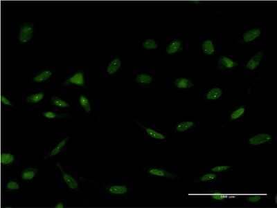 Immunocytochemistry/ Immunofluorescence: FoxC2 Antibody (1D4) [H00002303-M16]