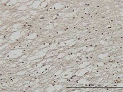 Immunohistochemistry-Paraffin: FoxC2 Antibody (2H3) [H00002303-M02]