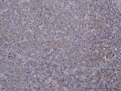 Immunohistochemistry-Paraffin: FoxC2 Antibody (2H3) [H00002303-M02]