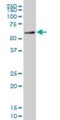 Western Blot: FoxC2 Antibody (3E6) [H00002303-M08]