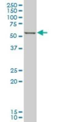 Western Blot: FoxC2 Antibody (3H5) [H00002303-M05]