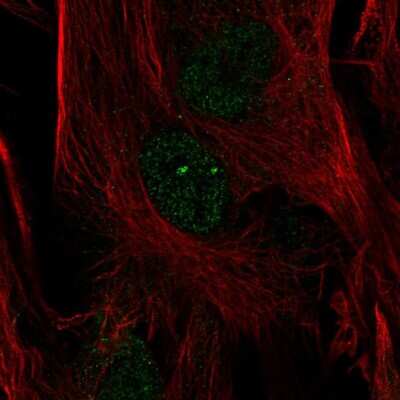 Immunocytochemistry/ Immunofluorescence: FoxC2 Antibody [NBP2-58056]