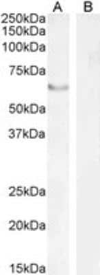 Western Blot: FoxC2 Antibody [NB100-1269]