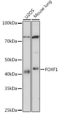 Western Blot: FoxF1 Antibody (8F6G3) [NBP3-16637]