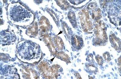 Immunohistochemistry: FoxF1 Antibody [NBP2-87467]