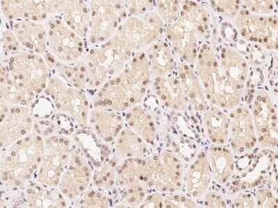 Immunohistochemistry-Paraffin: FoxF1 Antibody [NBP2-98870]