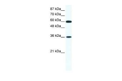 Western Blot: FoxF1 Antibody [NBP2-87466]