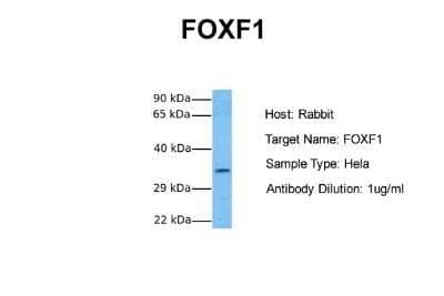 Western Blot: FoxF1 Antibody [NBP2-87467]