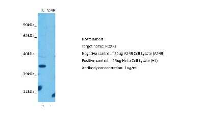 Western Blot: FoxF1 Antibody [NBP2-87467]