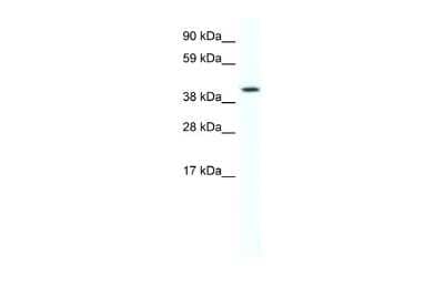 Western Blot: FoxF1 Antibody [NBP2-87468]