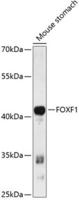 Western Blot: FoxF1 AntibodyAzide and BSA Free [NBP3-04753]