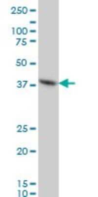Western Blot: FoxF2 Antibody (2G10) [H00002295-M04]