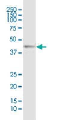 Western Blot: FoxF2 Antibody (2G10) [H00002295-M04]