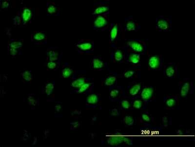 Immunocytochemistry/ Immunofluorescence: FoxF2 Antibody (3D11) [H00002295-M08]