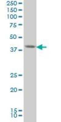 Western Blot: FoxF2 Antibody (3F5) [H00002295-M03]