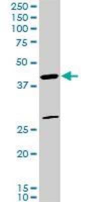 Western Blot: FoxF2 Antibody (3F5) [H00002295-M03]