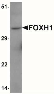 Western Blot: FoxH1 AntibodyBSA Free [NBP2-41196]