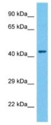 Western Blot: FoxH1 Antibody [NBP3-10401]