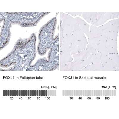 Immunohistochemistry-Paraffin: FoxJ1/HFH4 Antibody (CL3989) [NBP2-59032]