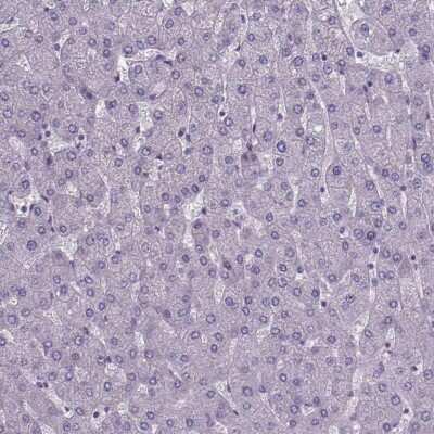 Immunohistochemistry-Paraffin: FoxJ1/HFH4 Antibody [NBP1-87928]