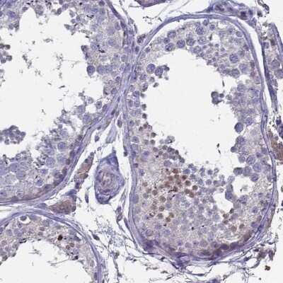 Immunohistochemistry-Paraffin: FoxJ1/HFH4 Antibody [NBP1-87928]