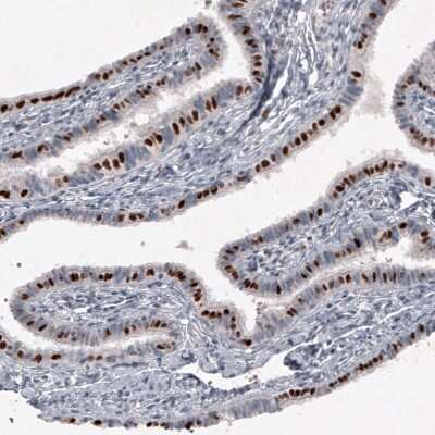 Immunohistochemistry-Paraffin: FoxJ1/HFH4 Antibody (CL3991) [NBP2-59033]