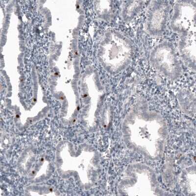 Immunohistochemistry-Paraffin: FoxJ1/HFH4 Antibody (CL3991) [NBP2-59033]