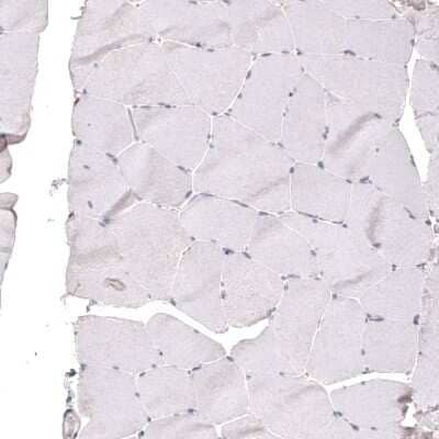 Immunohistochemistry-Paraffin: FoxJ1/HFH4 Antibody (CL3991) [NBP2-59033]