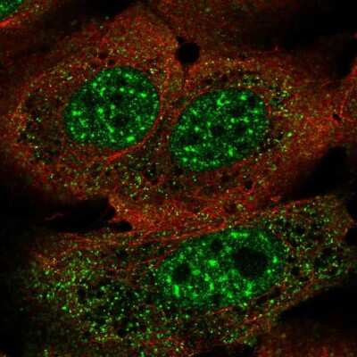 Immunocytochemistry/ Immunofluorescence: FoxJ3 Antibody [NBP2-57077]