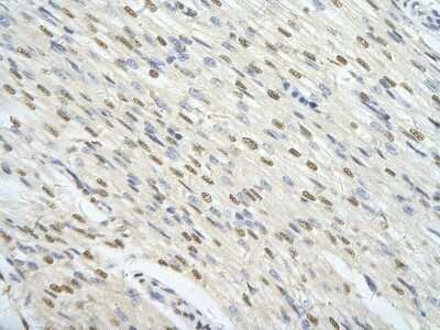 Immunohistochemistry-Paraffin: FoxJ3 Antibody [NBP3-10497]