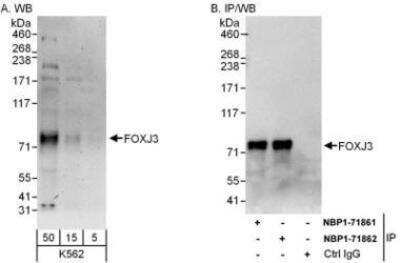 Western Blot: FoxJ3 Antibody [NBP1-71862]