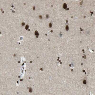 Immunohistochemistry-Paraffin: FoxK1 Antibody [NBP1-83110]