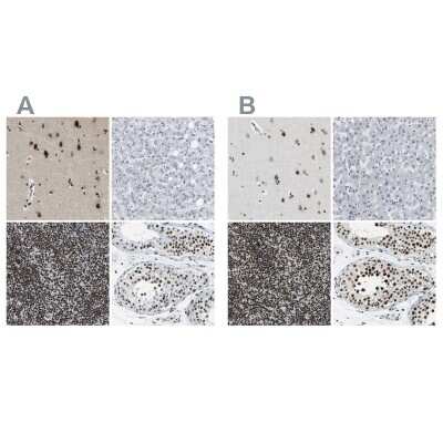 Immunohistochemistry-Paraffin: FoxK1 Antibody [NBP1-83110]
