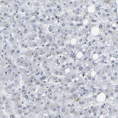 Immunohistochemistry-Paraffin: FoxK1 Antibody [NBP1-83110]