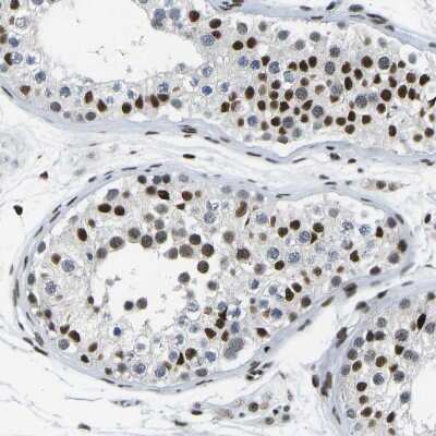 Immunohistochemistry-Paraffin: FoxK1 Antibody [NBP1-83110]