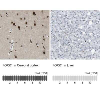 Immunohistochemistry-Paraffin: FoxK1 Antibody [NBP1-83110]