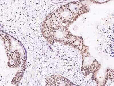 Immunohistochemistry-Paraffin: FoxK1 Antibody [NBP2-98878]