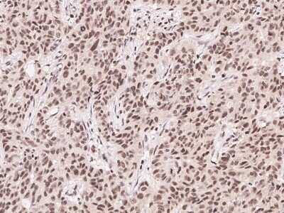 Immunohistochemistry-Paraffin: FoxK1 Antibody [NBP2-98878]