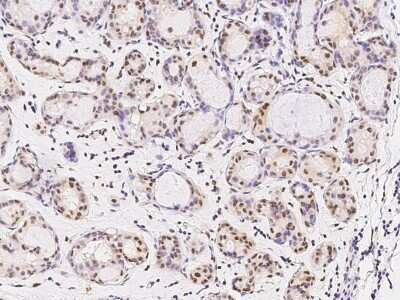 Immunohistochemistry-Paraffin: FoxK1 Antibody [NBP2-98879]