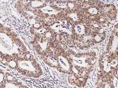 Immunohistochemistry-Paraffin: FoxK1 Antibody [NBP2-98879]
