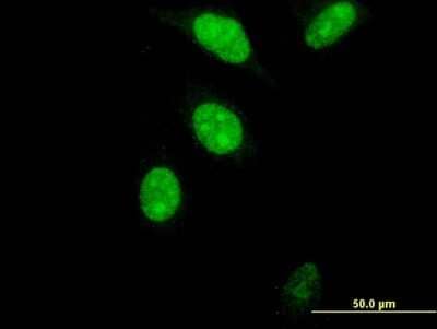 Immunocytochemistry/ Immunofluorescence: FoxM1 Antibody (2H4) [H00002305-M05]