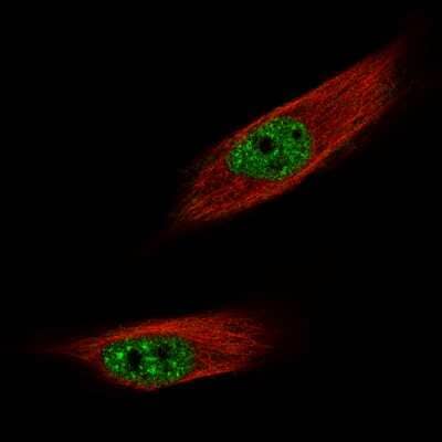 Immunocytochemistry/ Immunofluorescence: FoxM1 Antibody (CL12131) [NBP3-15129]