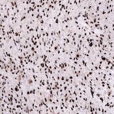 Immunohistochemistry-Paraffin: FoxM1 Antibody (CL12131) [NBP3-15129]