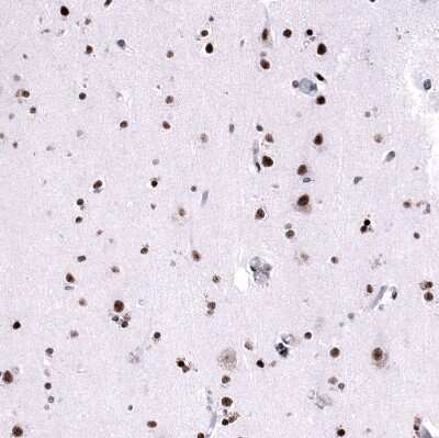 Immunohistochemistry-Paraffin: FoxM1 Antibody (CL12131) [NBP3-15129]