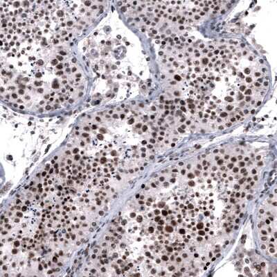 Immunohistochemistry-Paraffin: FoxM1 Antibody (CL12131) [NBP3-15129]