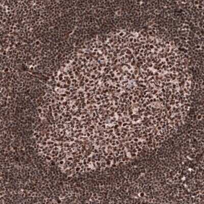 Immunohistochemistry-Paraffin: FoxM1 Antibody (CL12131) [NBP3-15129]