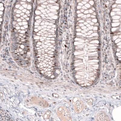 Immunohistochemistry-Paraffin: FoxM1 Antibody [NBP1-84671]