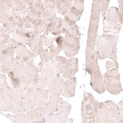 Immunohistochemistry-Paraffin: FoxM1 Antibody [NBP1-84671]