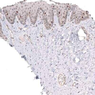 Immunohistochemistry-Paraffin: FoxM1 Antibody [NBP1-84671]