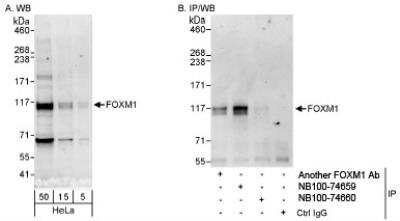 Western Blot: FoxM1 Antibody [NB100-74660]